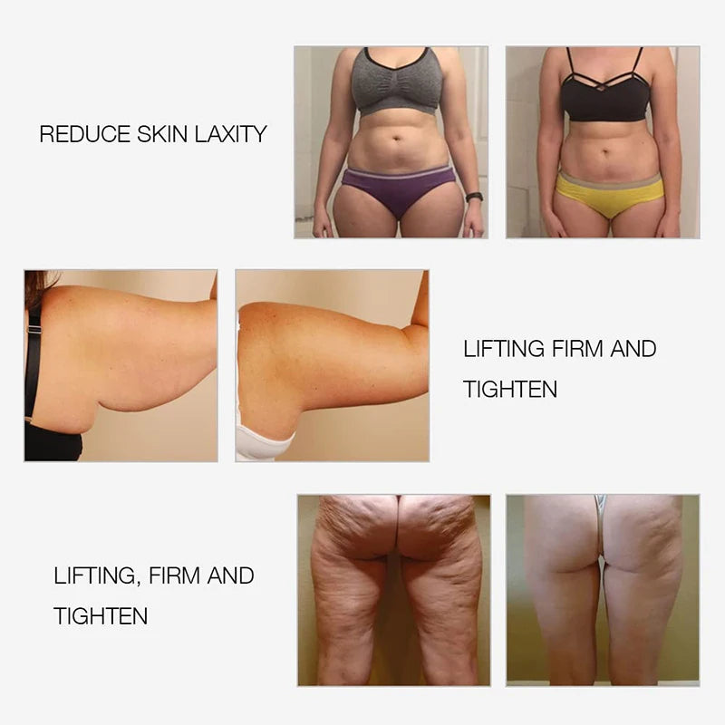 RF Body Slimming Massager | EMS Vibration Body Sculpting Device with LED Light Therapy & Skin Firming