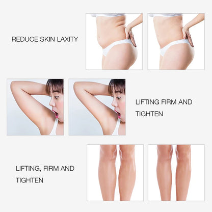 RF Body Slimming Massager | EMS Vibration Body Sculpting Device with LED Light Therapy & Skin Firming