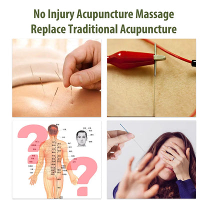 Electronic Acupuncture Pen with Auto Acupoint Detection | Needle-Free Pulse Stimulation, 9 Intensity Levels, 2 Probes & USB Rechargeable
