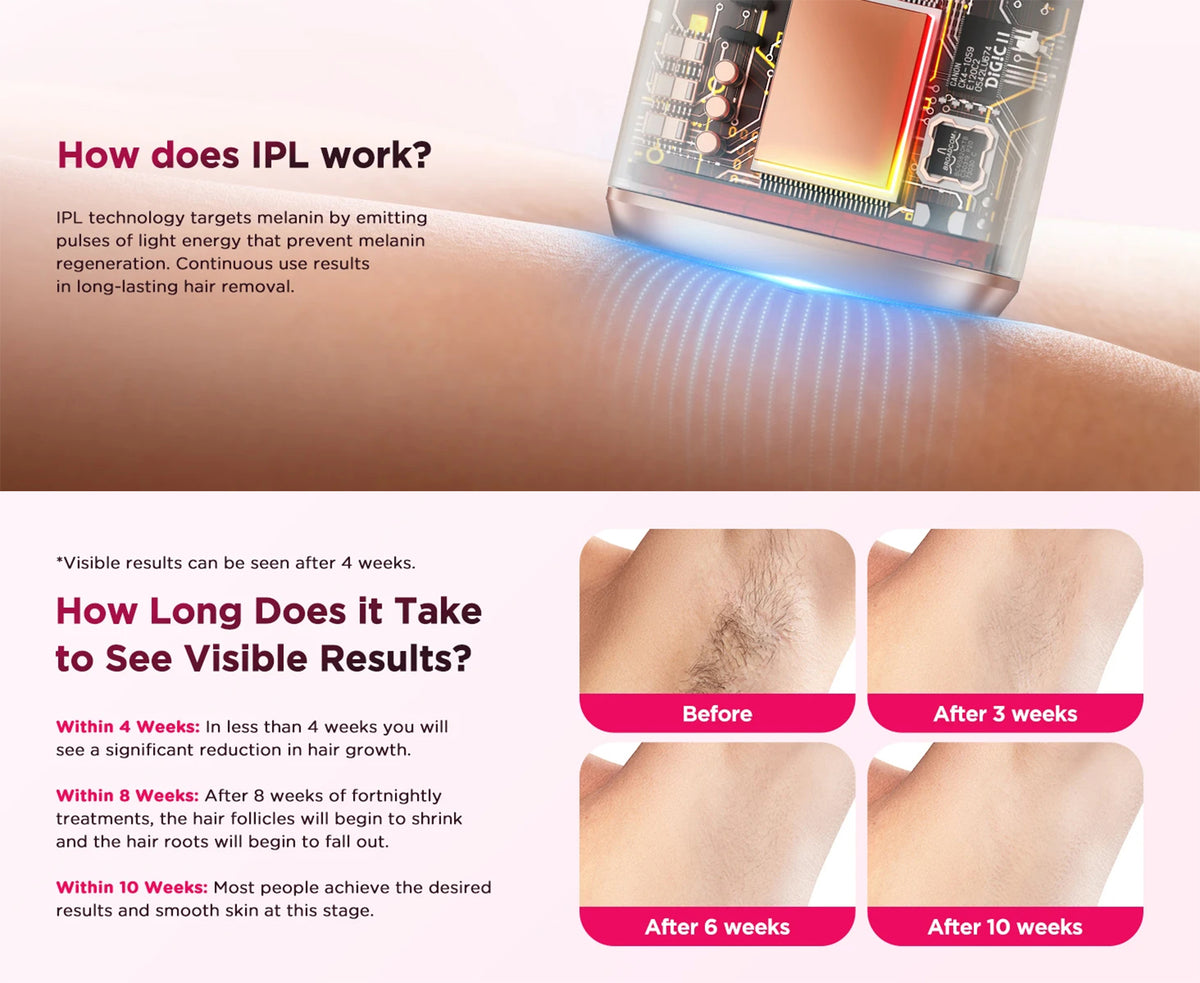 IPL Hair Removal Device with 9 Levels and Auto-Glide Mode