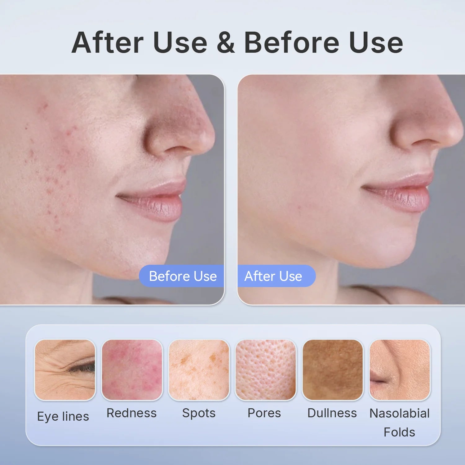 LED Light Therapy Face Mask | Wireless Red Blue Near Infrared Skin Care Mask with 4 Modes for Wrinkles, Acne & Glow