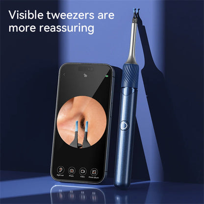 Ear Wax Removal Tool with 12MP Camera | Wi-Fi Ear Cleaner and LED Otoscope for iPhone and Android with Ear Picks