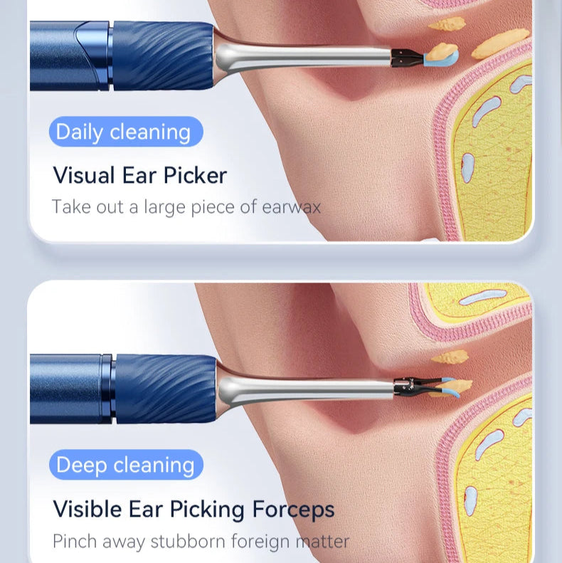 Ear Wax Removal Tool with 12MP Camera | Wi-Fi Ear Cleaner and LED Otoscope for iPhone and Android with Ear Picks