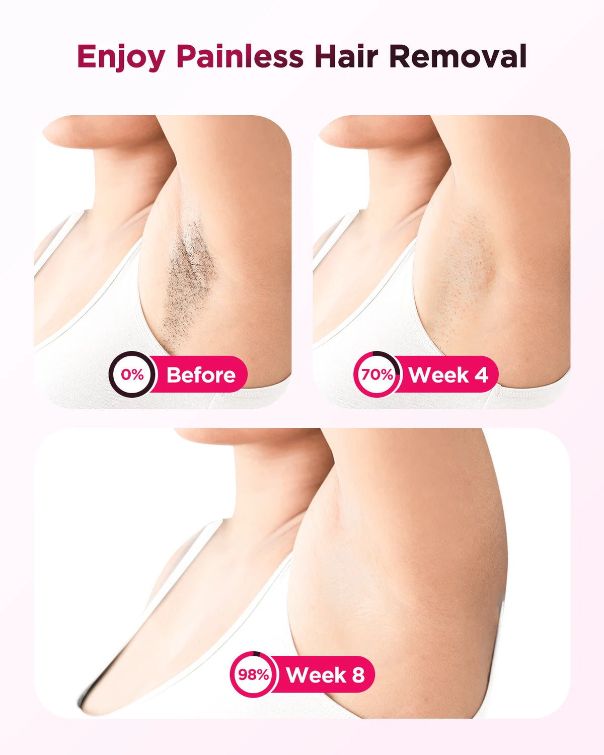 IPL Hair Removal Device with 9 Levels and Auto-Glide Mode