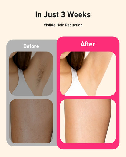 IPL Hair Removal Device | 999,999 Flashes, 9 Energy Levels, Auto & Manual Modes for At-Home Hair Removal
