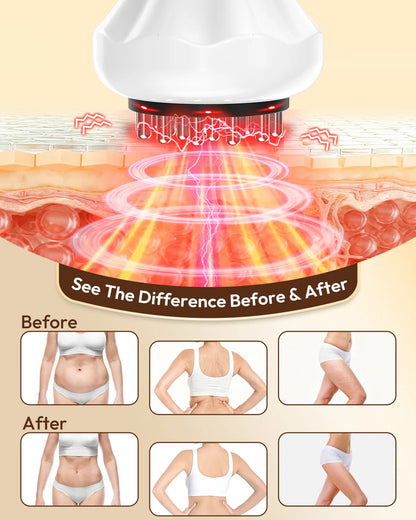 Lymphatic Drainage Massager with Heat | Anti Cellulite Body Massager with Vibration, 3 Modes & 9 Intensities
