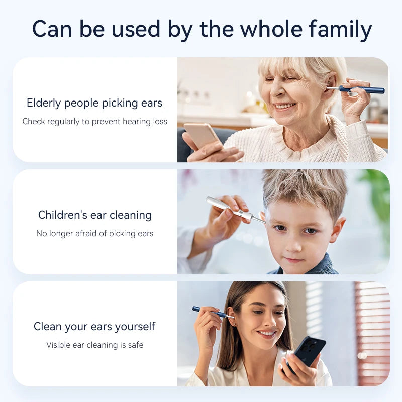 Ear Wax Removal Tool with 12MP Camera | Wi-Fi Ear Cleaner and LED Otoscope for iPhone and Android with Ear Picks